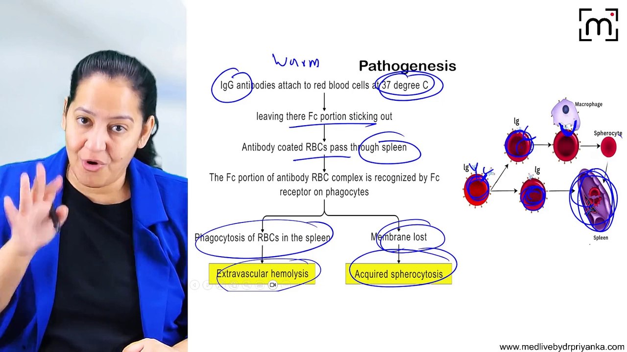 9. Autoimmune Hemolytic Anemia (AIHA)