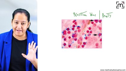 13. Sideroblastic Anemia