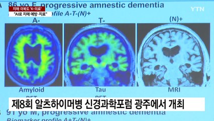 치매 극복도 'K-의료'..."AI 접목 치매 예방·치료" / YTN