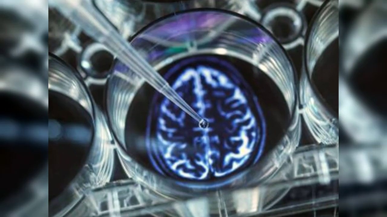 Las mujeres tienen mayor riesgo de padecer Alzheimer