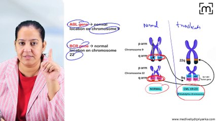 4. Chronic Myeloid Leukemia (CML)