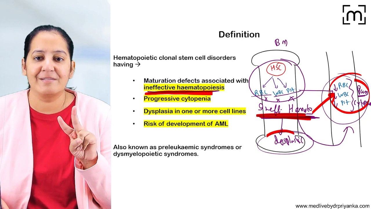 9. Myelodysplatic Syndrome (MDS)