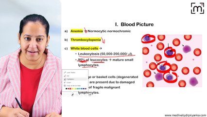 7. Chronic Lymphocytic Leukemia (CLL)