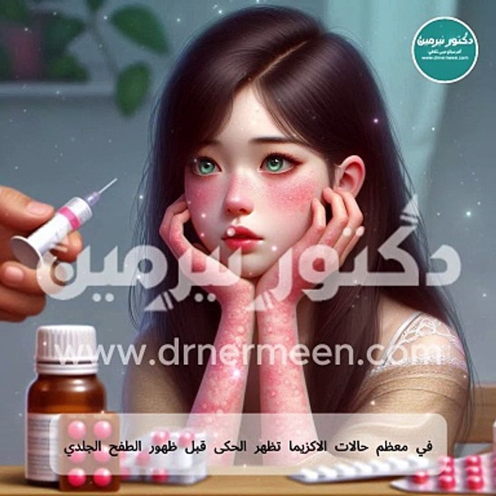 اعراض الاكزيما #أعراض #عرض #مرض #الاكزيما #الصدفية #البهاق #الجلدية #امراض_جلدية #امراض #اكزيما #اكزيما_الجلد_عن_الكبار_والصغار