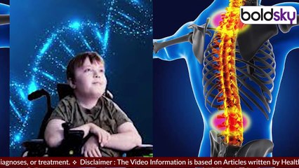 Spinal Muscular Atorphy क्या होता है, Symptoms, Treatment, Injection Price...