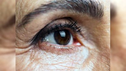 Trasplantes de córnea son los más frecuentes en el país