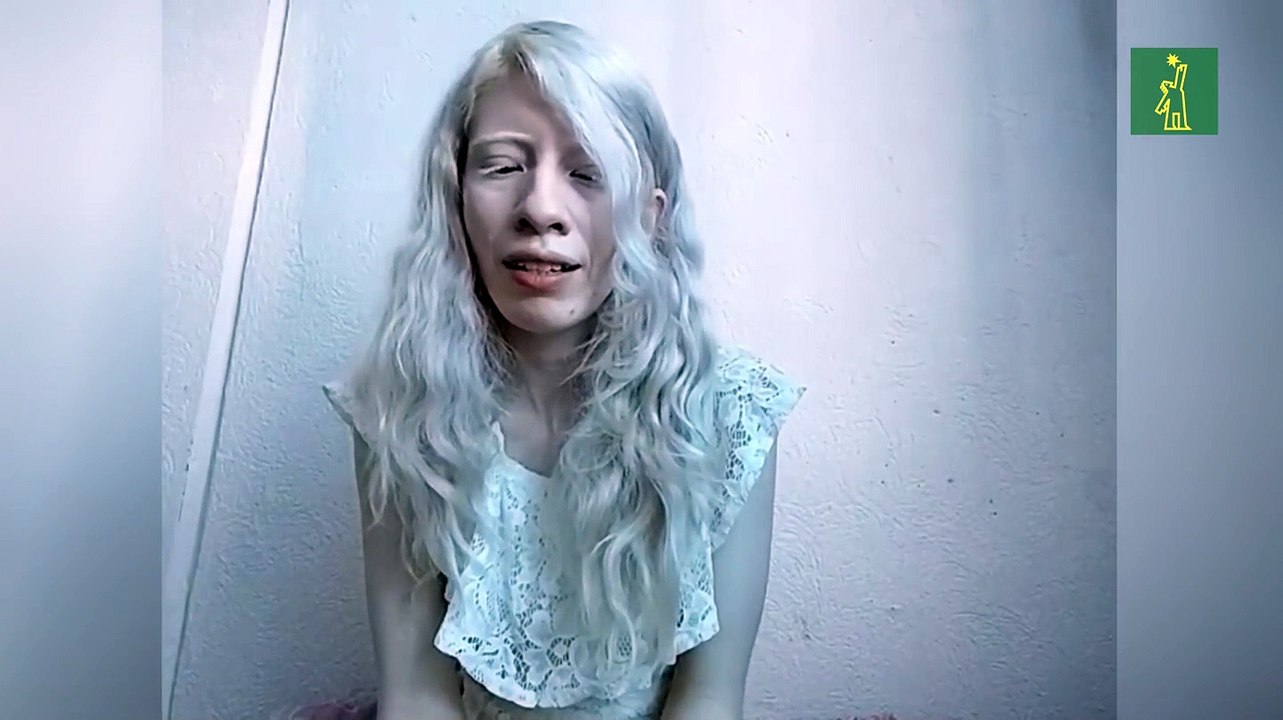 Modelo albina mexicana que aprendió a abrazar su condición