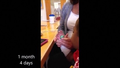 Primer trasplante de manos en un niño es un éxito