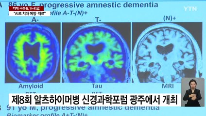 치매 극복도 'K-의료'..."AI 접목 치매 예방·치료" / YTN