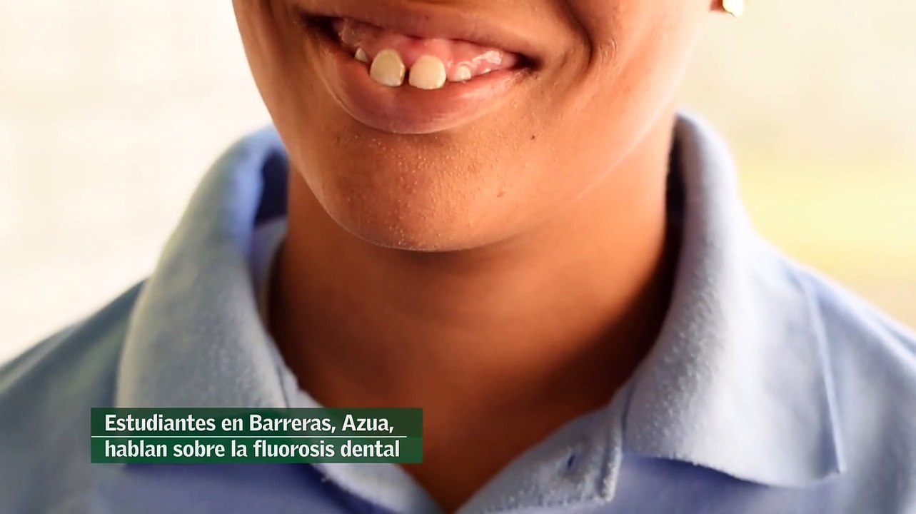 Niños con Fluorosis