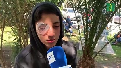 Chile se conmueve con las heridas oculares de los jóvenes manifestantes