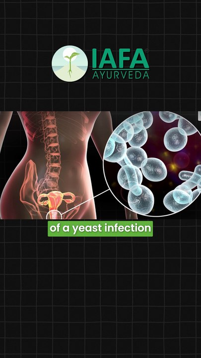 How to Get Rid of Yeast Infection Naturally? #shorts