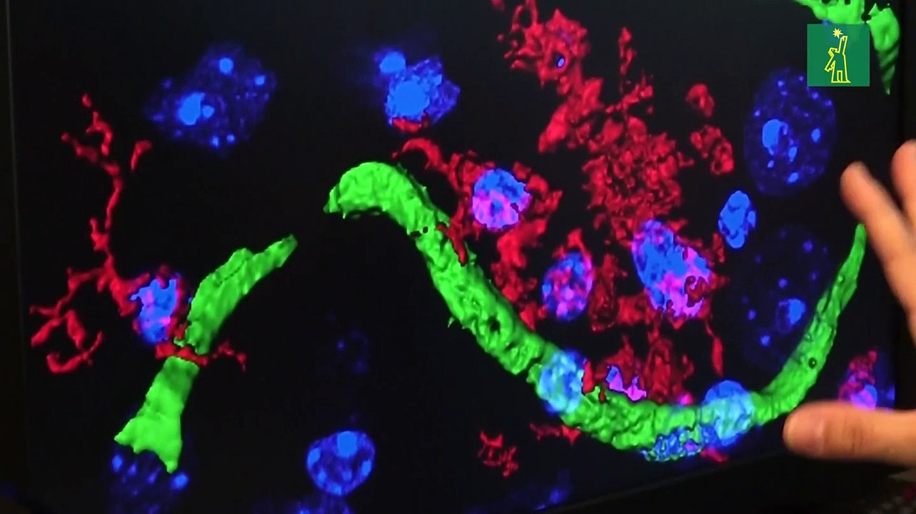 Un anticoagulante oral abre una vía para luchar contra el alzhéimer