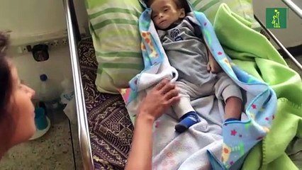 Uno de cada tres niños pequeños sufre desnutrición o sobrepeso en el mundo