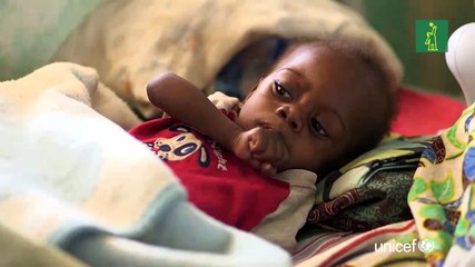 Penélope Cruz llama a afrontar la emergencia olvidada de la desnutrición infantil