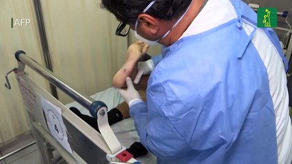 Más de 50.000 casos de viruela del mono en todo el mundo