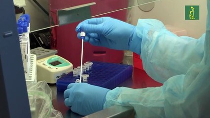 Investigadores Uruguayos se acercan al tratamiento de ELA y Alzheimer