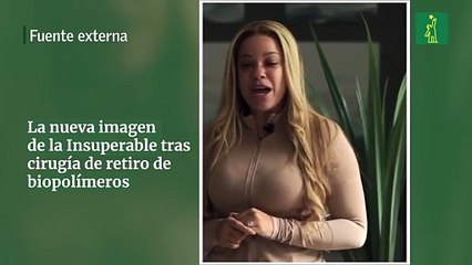 La nueva imagen de la Insuperable tras cirugía de retiro de biopolímeros