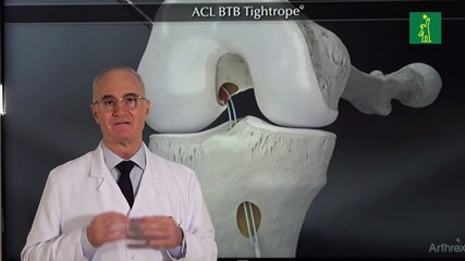 Ripoll: "Lesión rodilla es entre tres y seis veces más habitual en mujeres"