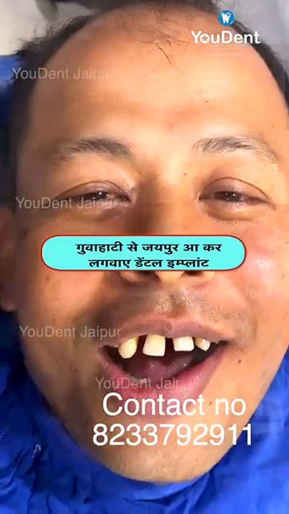 Best Dentist in Bathinda: Your Trusted Partner for Dental Health