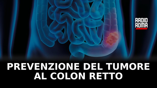 Informazione è salute: la prevenzione del tumore al colon retto - con Prof. Giovanna Del Vecchio Blanco