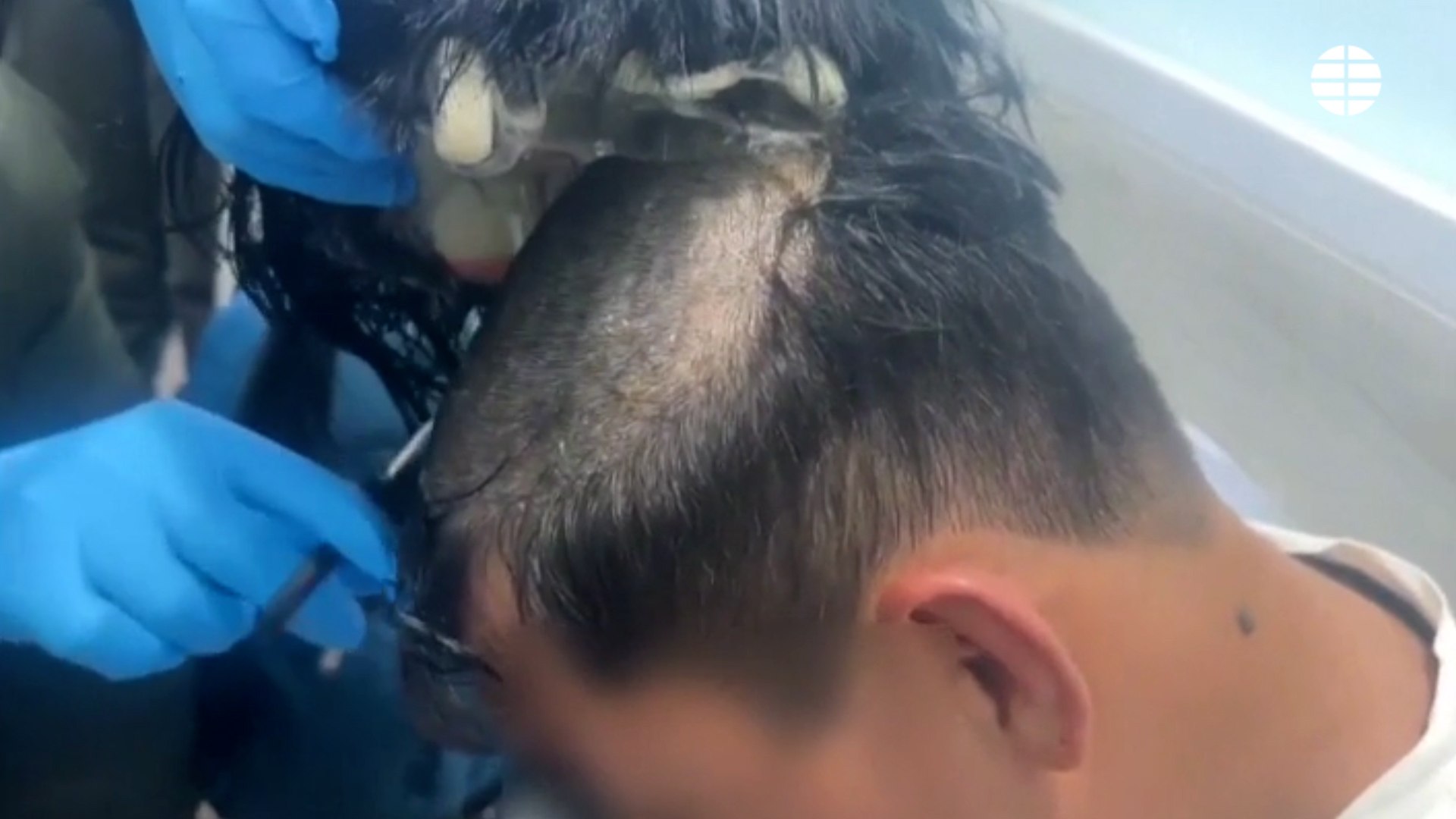 A este hombre de 40 años le salió caro el corte de pelo. Fue interceptado en Colombia cuando transportaba hasta 19 cápsulas de cocaína escondidas en una peluca, un total de diez mil euros de droga. Los agentes descubrieron la 'narcopeluca' gracias a a un escáner. Fue pillado por los pelos, literalmente.