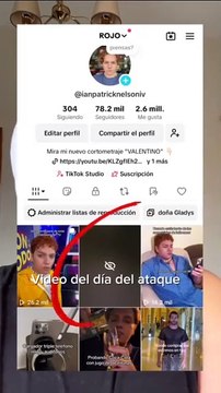 Influencer hondureño Patrick Nelson denuncia brutal agresión física
