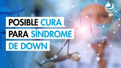 Descubren posible cura para el síndrome de Down mediante genética