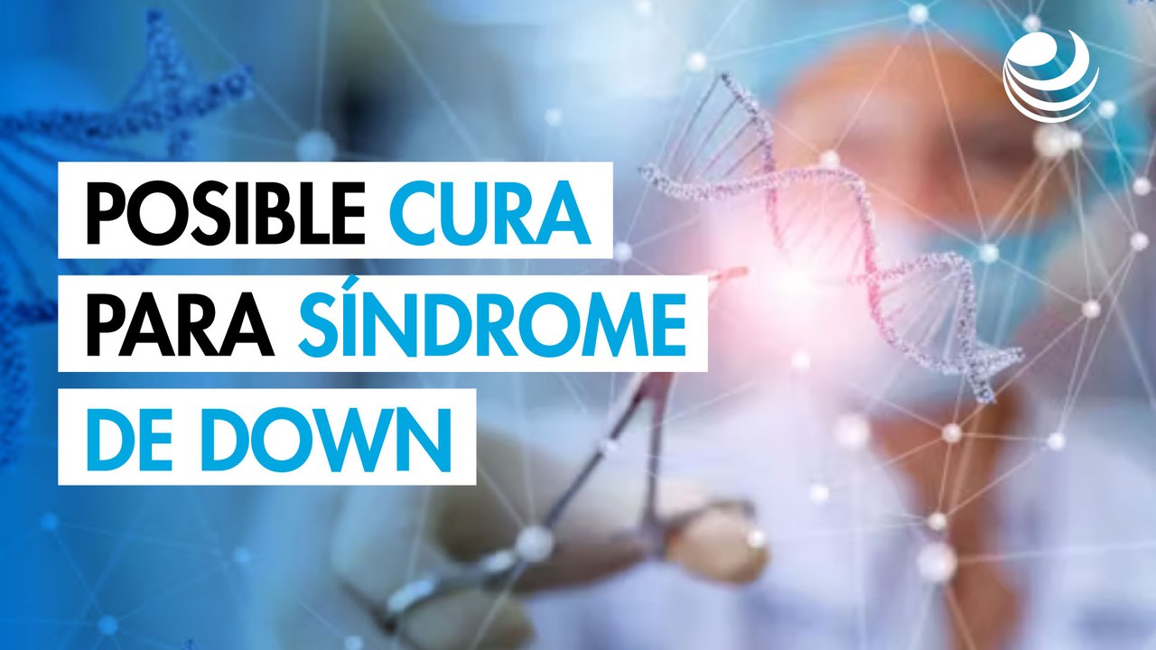 Descubren posible cura para el síndrome de Down mediante genética