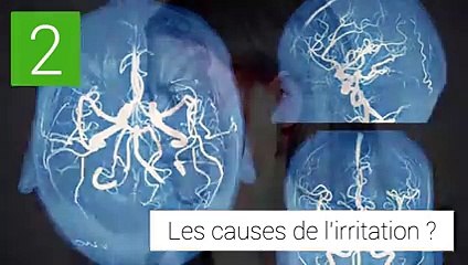 Névralgie faciale (névralgie du trijumeau)