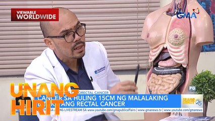 UH Clinic — Colorectal cancer | Unang Hirit
