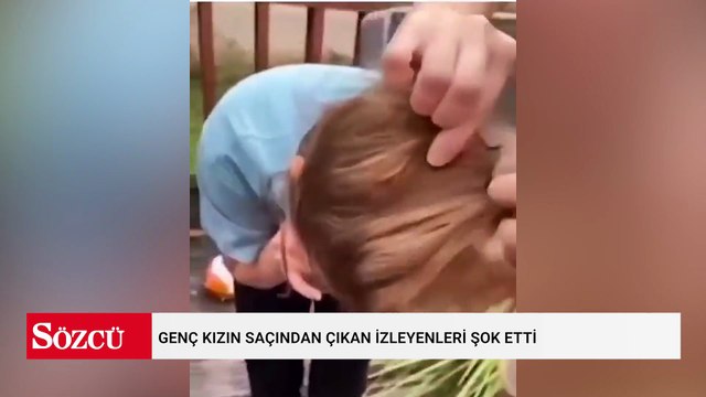 Saçında yuva yapmış! Topuzun altından çıkan şey herkesi dehşete düşürdü