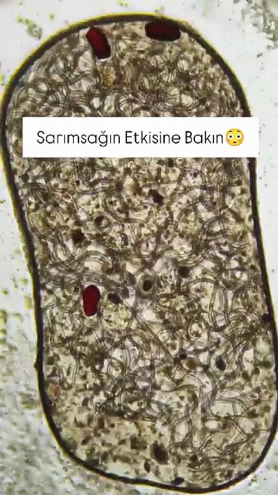 Sarımsağın mikroplara karşı verdiği mücadele so...