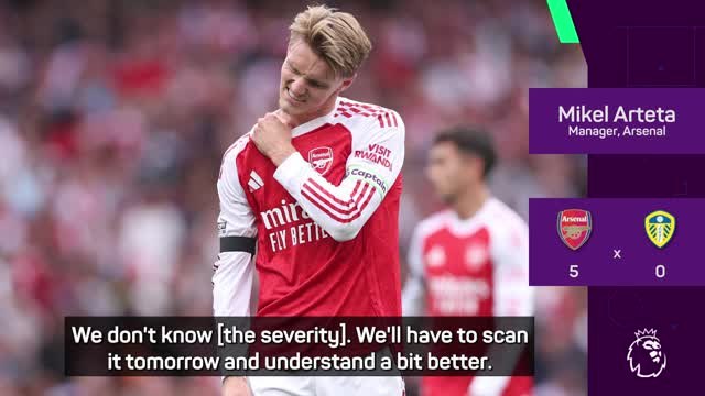 We'll have to wait on Odegaard and Saka injuries - Arteta