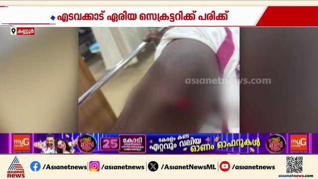കണ്ണൂരിൽ SFI പ്രവർത്തകന് കുത്തേറ്റു; ആക്രമം നടത്തിയത് ബൈക്കിലെത്തിയ സംഘം