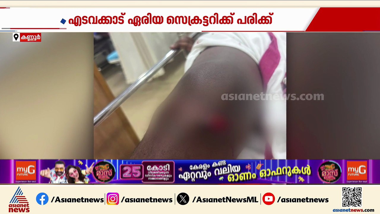 കണ്ണൂരിൽ SFI പ്രവർത്തകന് കുത്തേറ്റു; ആക്രമം നടത...