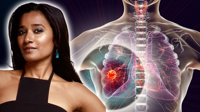 Tannishtha Chatterjee Cancer: Oligometastatic Cancer क्या होता है, Symptoms & Treatment | Boldsky