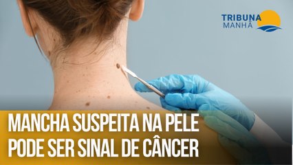 Mancha suspeita na pele pode ser sinal de câncer