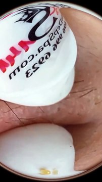 ASMR : Soin du Visage Ultra-Relaxant (Frissons Garantis !)