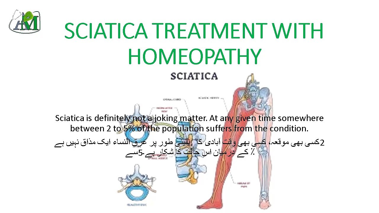 SCIATICA TREATMENT WITH