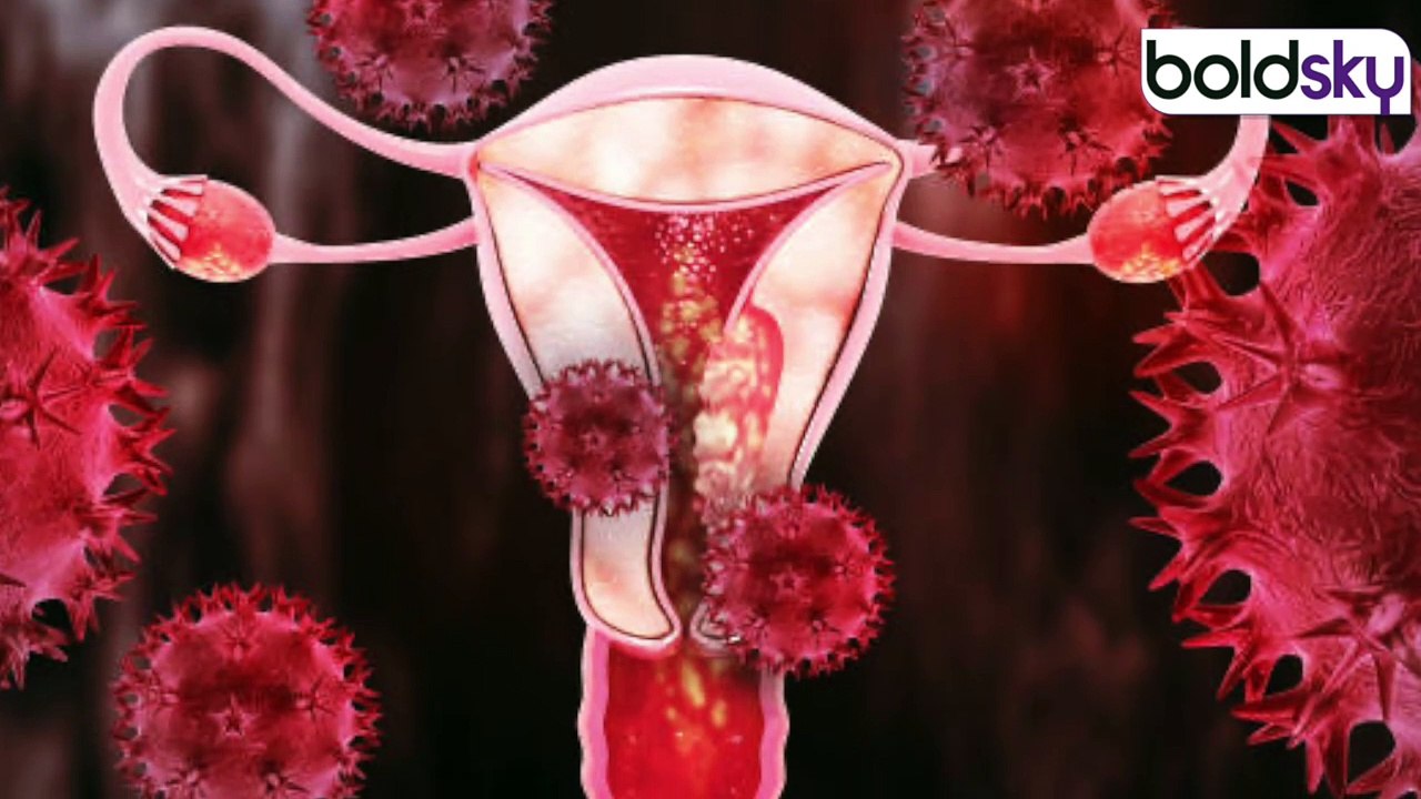 Pelvic Inflammatory Disease क्या होता है, Causes, Symptoms & Treatment| Is It Curable...|Boldsky