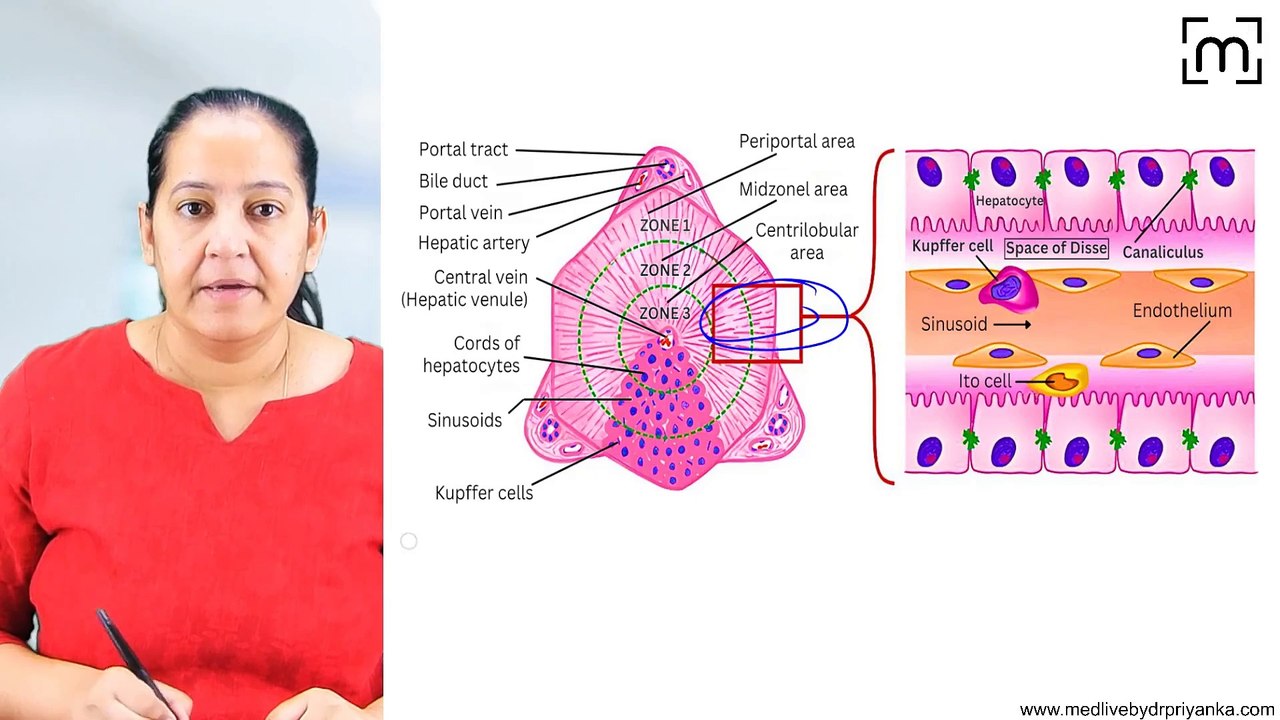 4. Cirrhosis