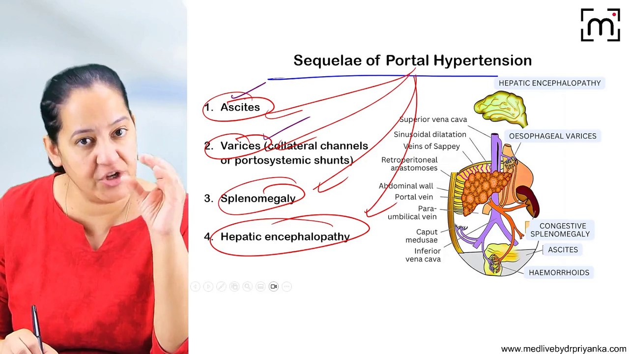 9. Portal Hypertension
