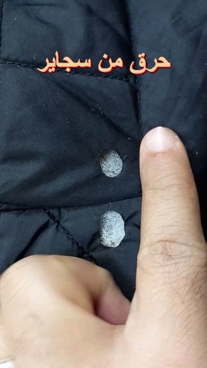 Cigarette burns on any jacket can be easily fixed.