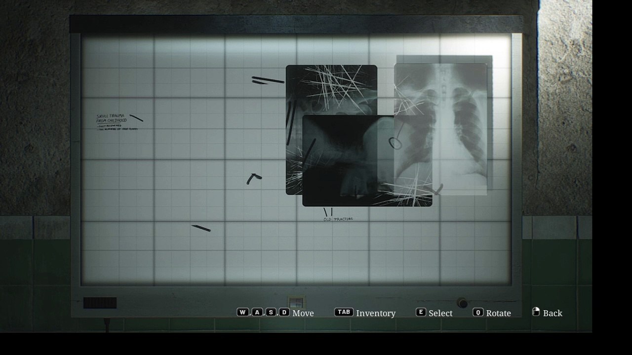 silent hill 2  radiography mission