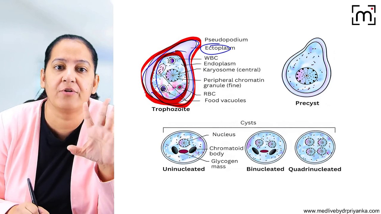 13. Infectious Enterocolitis - Typhoid,TB & Amoebic Ulcer