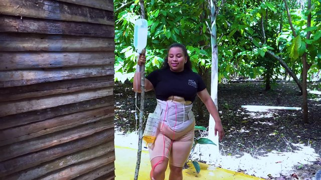 Se Hizo una Lipo sin tener dinero y esto paso LOS SOCIOS SOY