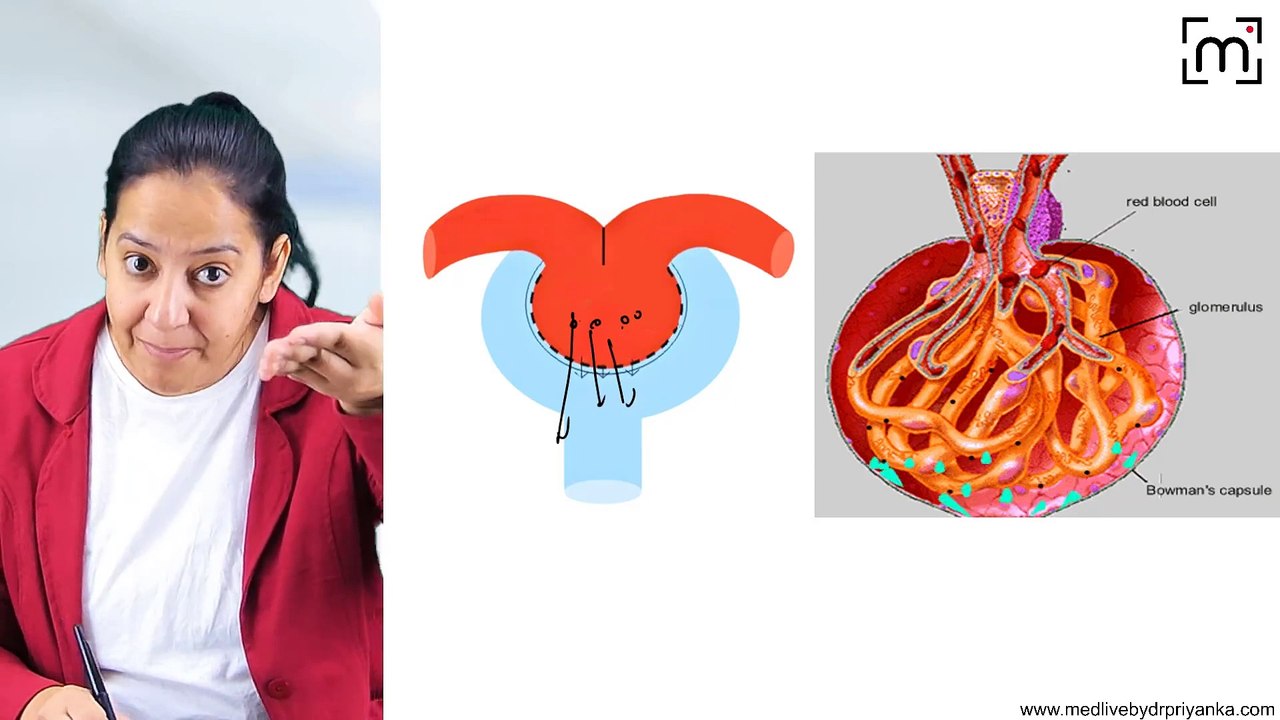 3. Glomerulonephritis