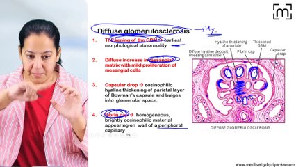 5. Diabetic Nephropathy
