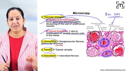 8. Kidney changes in Hypertension